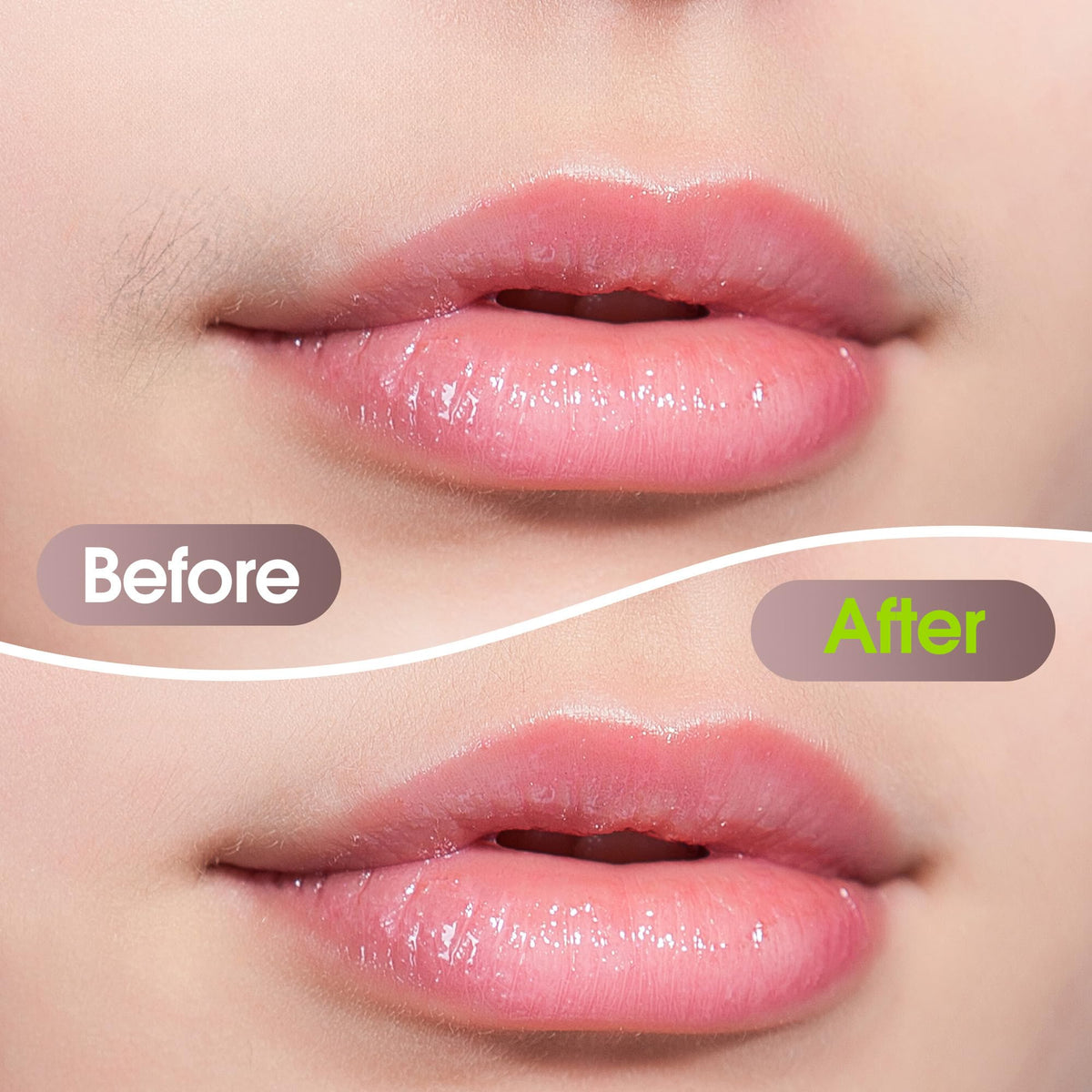 Electric Facial Hair Removal Device for Women S515810
